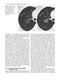 Whole Body Computed Tomography Angiography