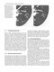 Whole Body Computed Tomography Angiography