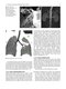 Whole Body Computed Tomography Angiography