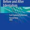 Treatment Options Before and After Edentulism: Tooth Supported Overdentures 1st ed