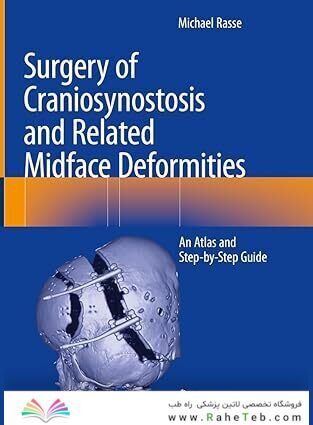 Surgery of Craniosynostosis and Related Midface Deformities: An Atlas and Step-by-Step Guide