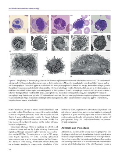 Hoffbrand's Postgraduate Haematology 8th Edition