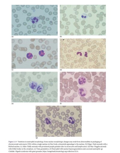 Hoffbrand's Postgraduate Haematology 8th Edition