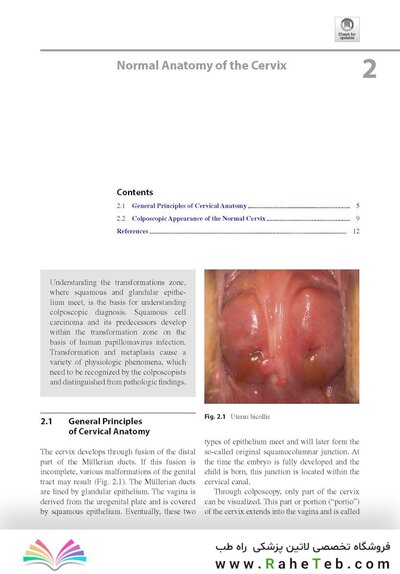 Colposcopy: Comprehensive Textbook and Atlas 1st ed