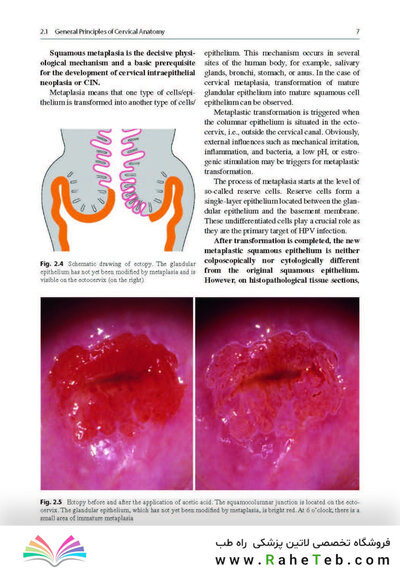 Colposcopy: Comprehensive Textbook and Atlas 1st ed