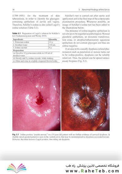 Colposcopy: Comprehensive Textbook and Atlas 1st ed