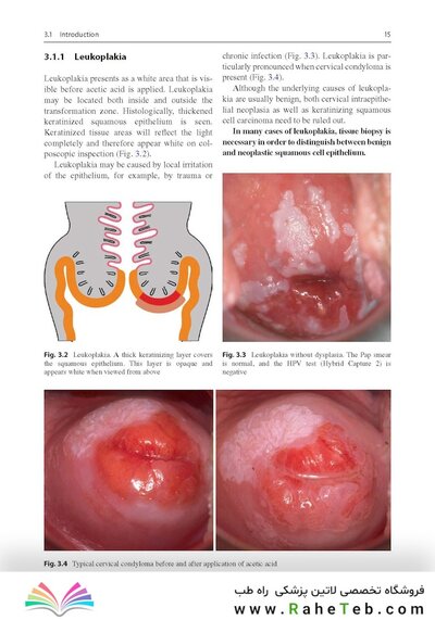 Colposcopy: Comprehensive Textbook and Atlas 1st ed