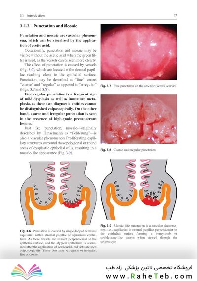 Colposcopy: Comprehensive Textbook and Atlas 1st ed