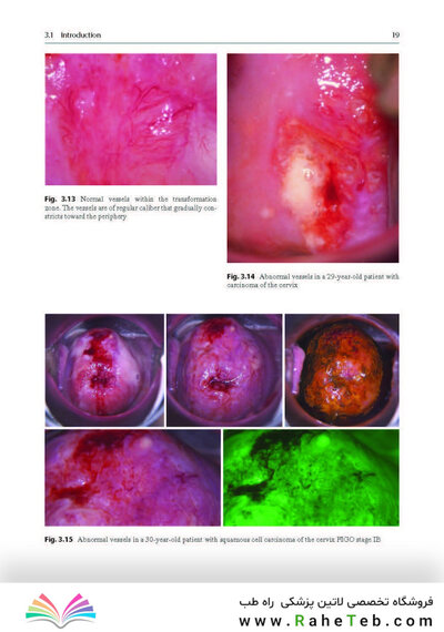 Colposcopy: Comprehensive Textbook and Atlas 1st ed