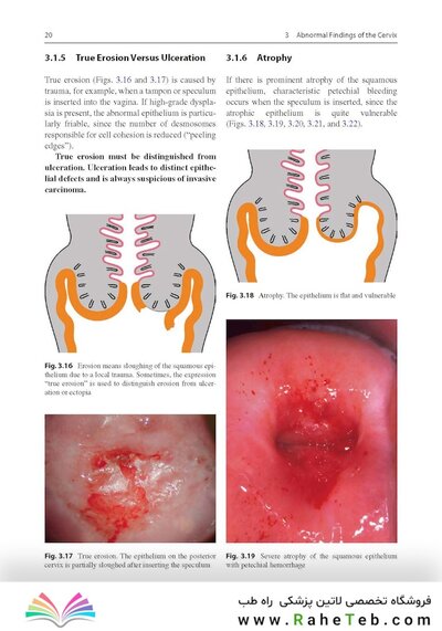 Colposcopy: Comprehensive Textbook and Atlas 1st ed
