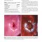 Colposcopy: Comprehensive Textbook and Atlas 1st ed