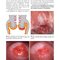 Colposcopy: Comprehensive Textbook and Atlas 1st ed