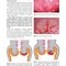 Colposcopy: Comprehensive Textbook and Atlas 1st ed
