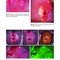 Colposcopy: Comprehensive Textbook and Atlas 1st ed