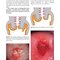 Colposcopy: Comprehensive Textbook and Atlas 1st ed