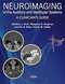 Neuroimaging of the Auditory and Vestibular Systems: A Clinician’s Guide 1st Edition