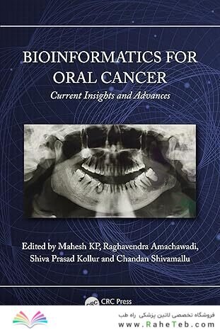 Bioinformatics for Oral Cancer: Current Insights and Advances 1st Edition