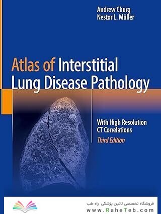 Atlas of Interstitial Lung Disease Pathology: With High Resolution CT Correlations Third Edition