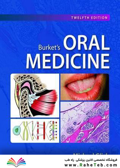 Burket's Oral Medicine