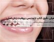بررسی تخصصی کتاب ارتودنسی پروفیت (ویرایش 2013 تا جدیدترین نسخه زبان اصلی)