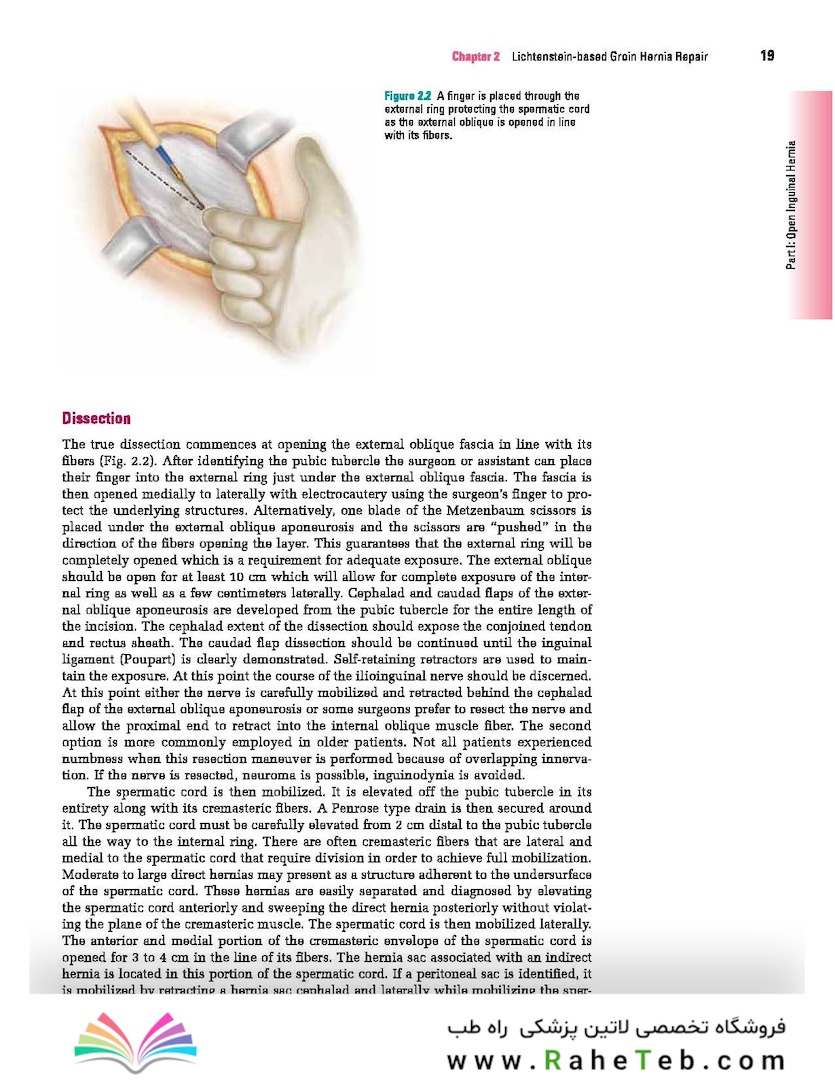 Master Techniques in Surgery: Hernia