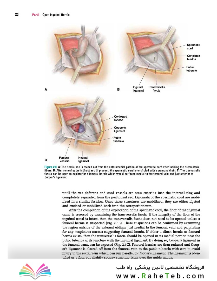 Master Techniques in Surgery: Hernia