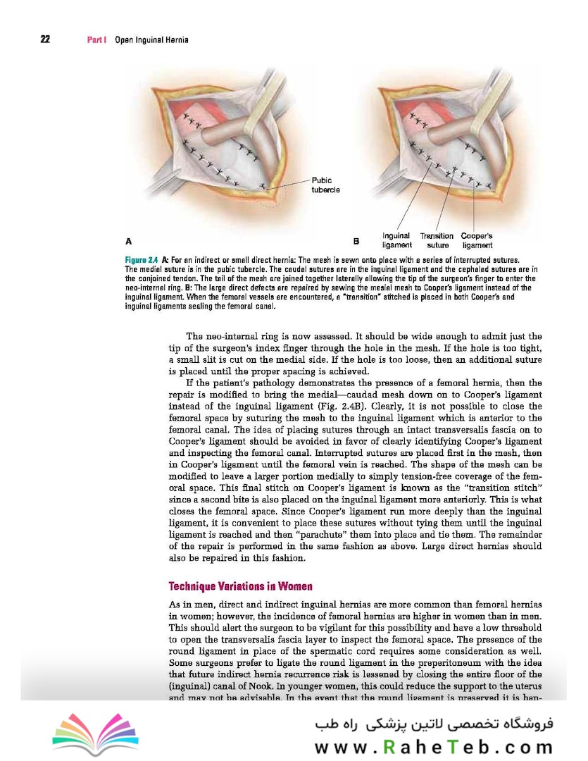 Master Techniques in Surgery: Hernia