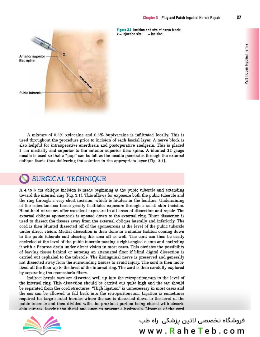 Master Techniques in Surgery: Hernia