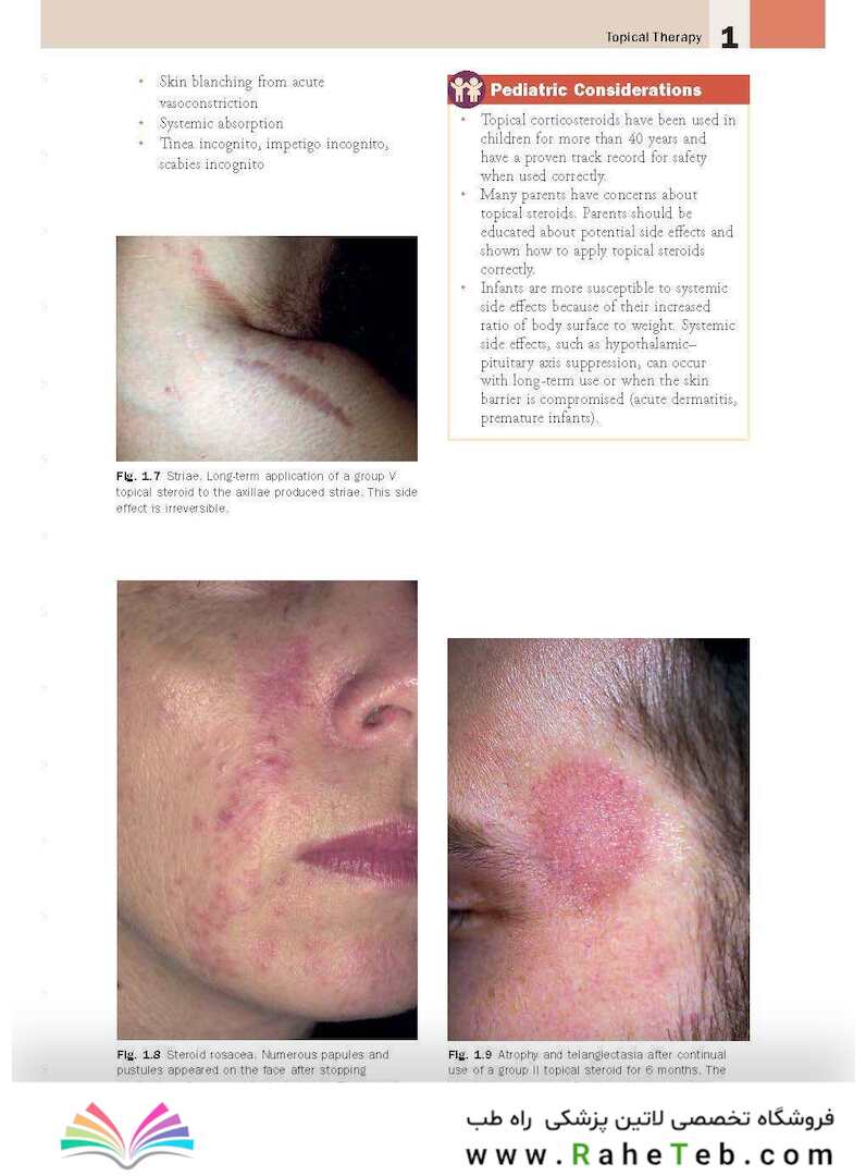 Skin Disease: Diagnosis and Treatment 4th Edition 2018