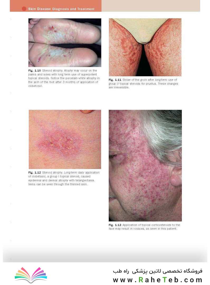 Skin Disease: Diagnosis and Treatment 4th Edition 2018