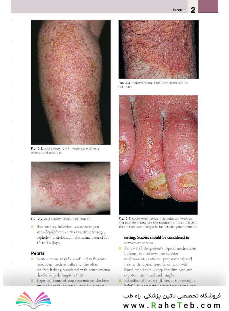 Skin Disease: Diagnosis and Treatment 4th Edition 2018