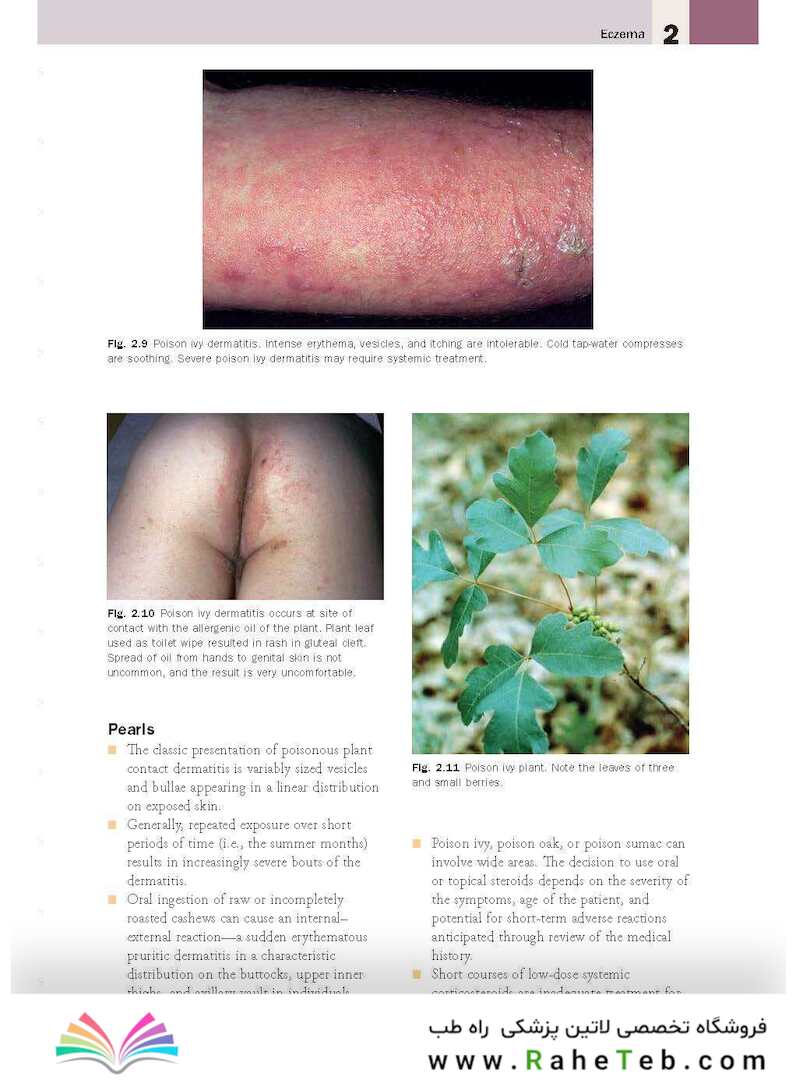 Skin Disease: Diagnosis and Treatment 4th Edition 2018
