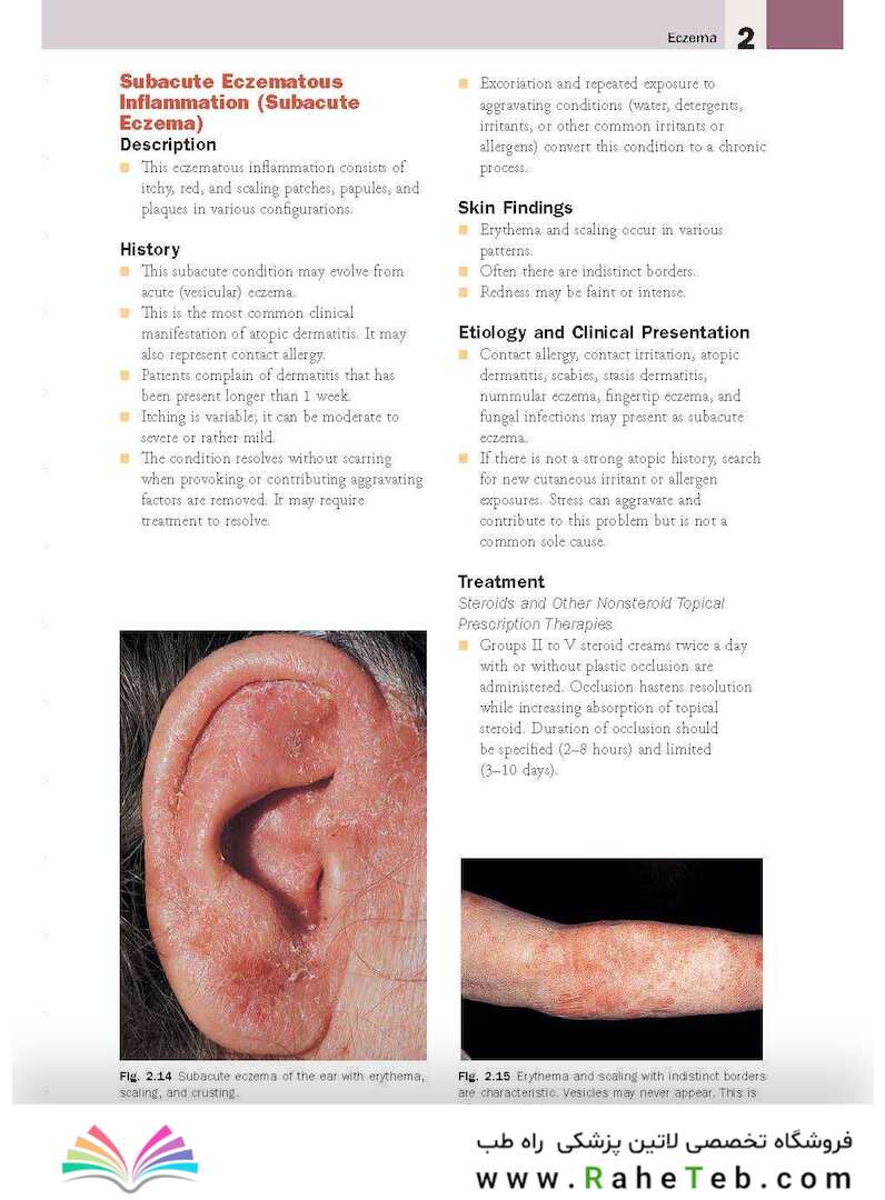 Skin Disease: Diagnosis and Treatment 4th Edition 2018