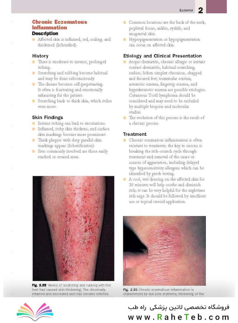 Skin Disease: Diagnosis and Treatment 4th Edition 2018