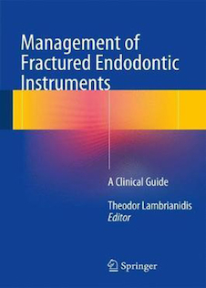 Management of Fractured Endodontic Instruments : A Clinical Guide
