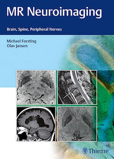 تخفیف MR Neuroimaging : Brain, Spine, and Peripheral Nerves