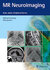 MR Neuroimaging : Brain, Spine, and Peripheral Nerves