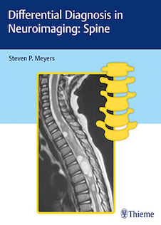 عکس Differential Diagnosis in Neuroimaging: Spine 1st Edición