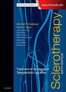 تخفیف Sclerotherapy : Treatment of Varicose and Telangiectatic Leg Veins