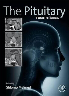 تخفیف The Pituitary