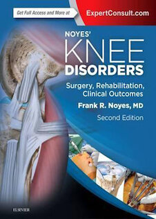 تخفیف Noyes' Knee Disorders: Surgery, Rehabilitation, Clinical Outcomes