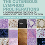 The Cutaneous Lymphoid Proliferations 