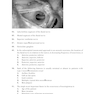 Neurosurgery Board Review : Questions and Answers for Self-Assessment