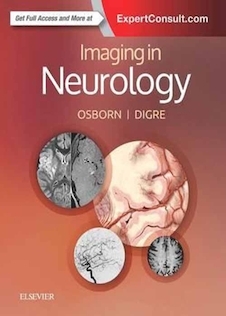 تخفیف Imaging in Neurology