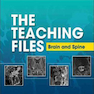 The Teaching Files: Brain and Spine : Expert Consult - Online and Print