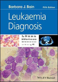 عکس Leukaemia Diagnosis