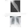 Workbook for Radiographic Image Analysis 5th Edicion