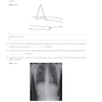 Workbook for Radiographic Image Analysis 5th Edicion