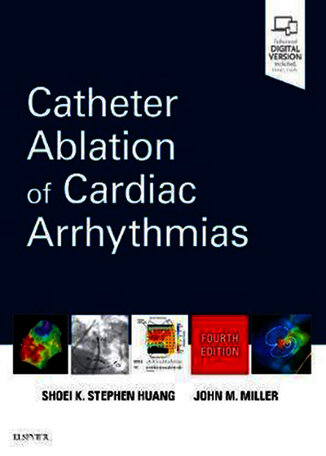 عکس Catheter Ablation of Cardiac Arrhythmias