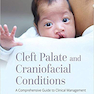 Cleft Palate And Craniofacial Conditions